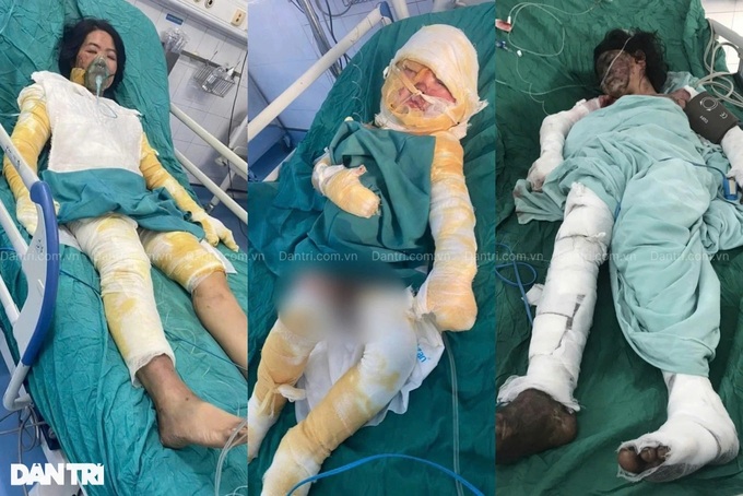 Bac Ninh man needs help to save family from serious burns - 1