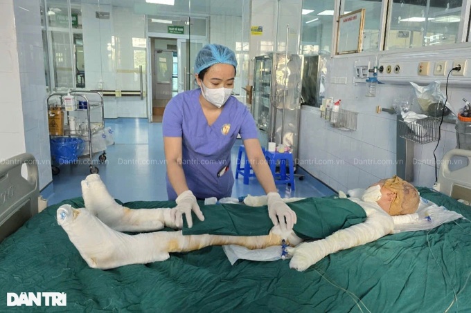 Bac Ninh man needs help to save family from serious burns - 2